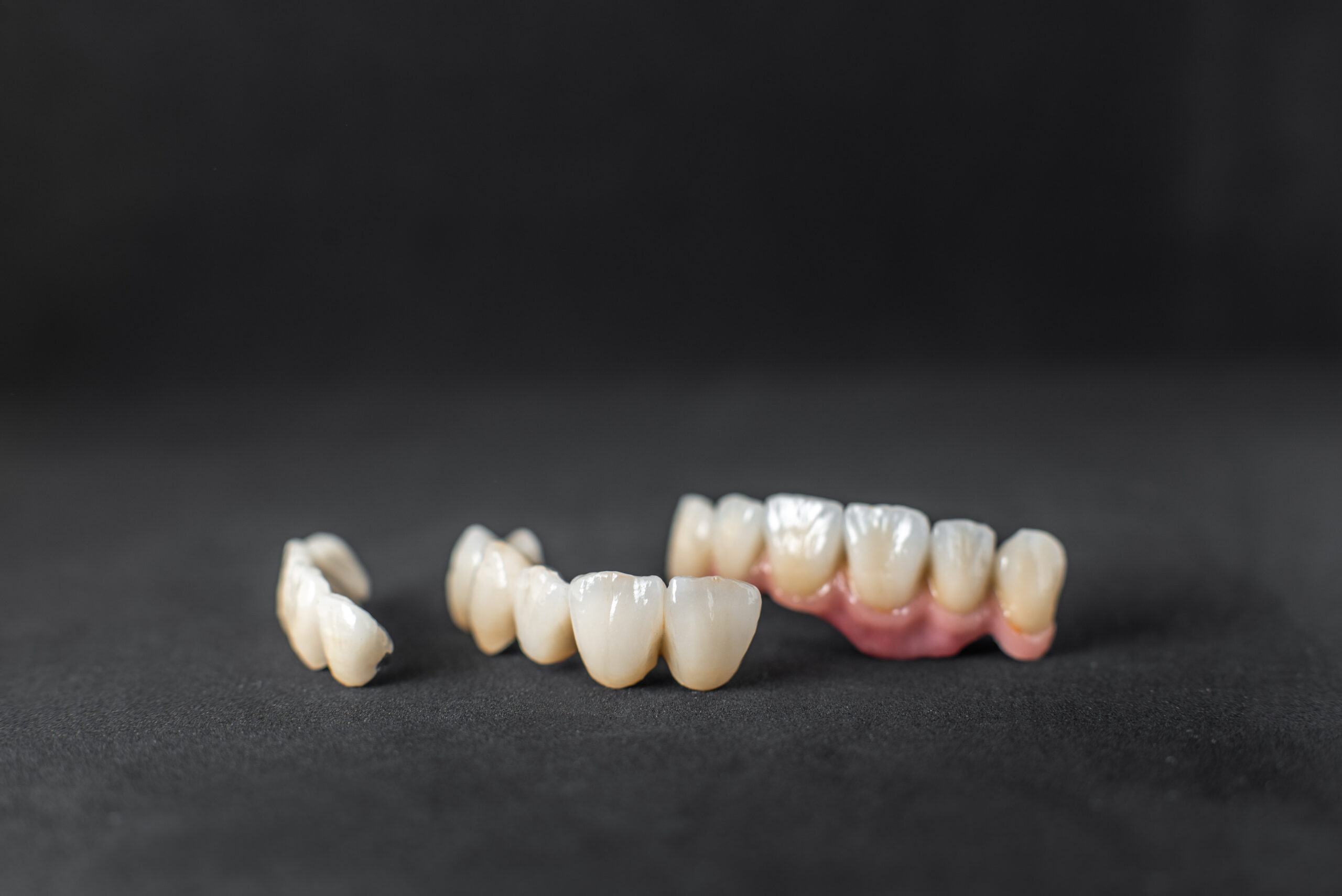 When Should You Get a Dental Crown