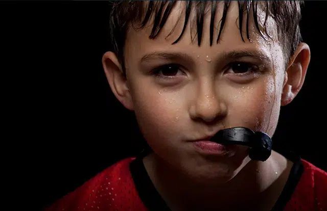 Custom Mouth Guards Greer Sc - Cove Dental Care