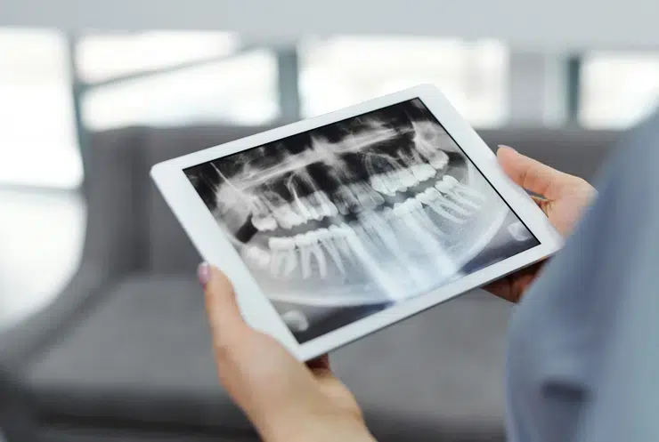 Dental X-Rays Greer Sc - Cove Dental Care