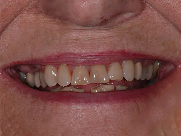 Before treatment