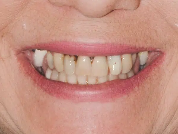 Before treatment