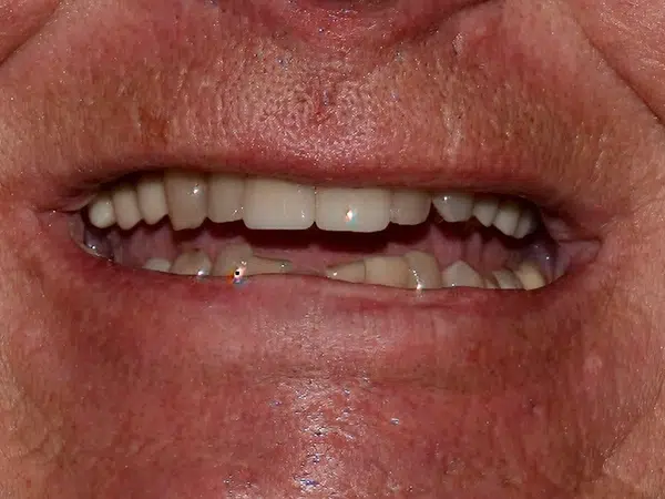 Before treatment