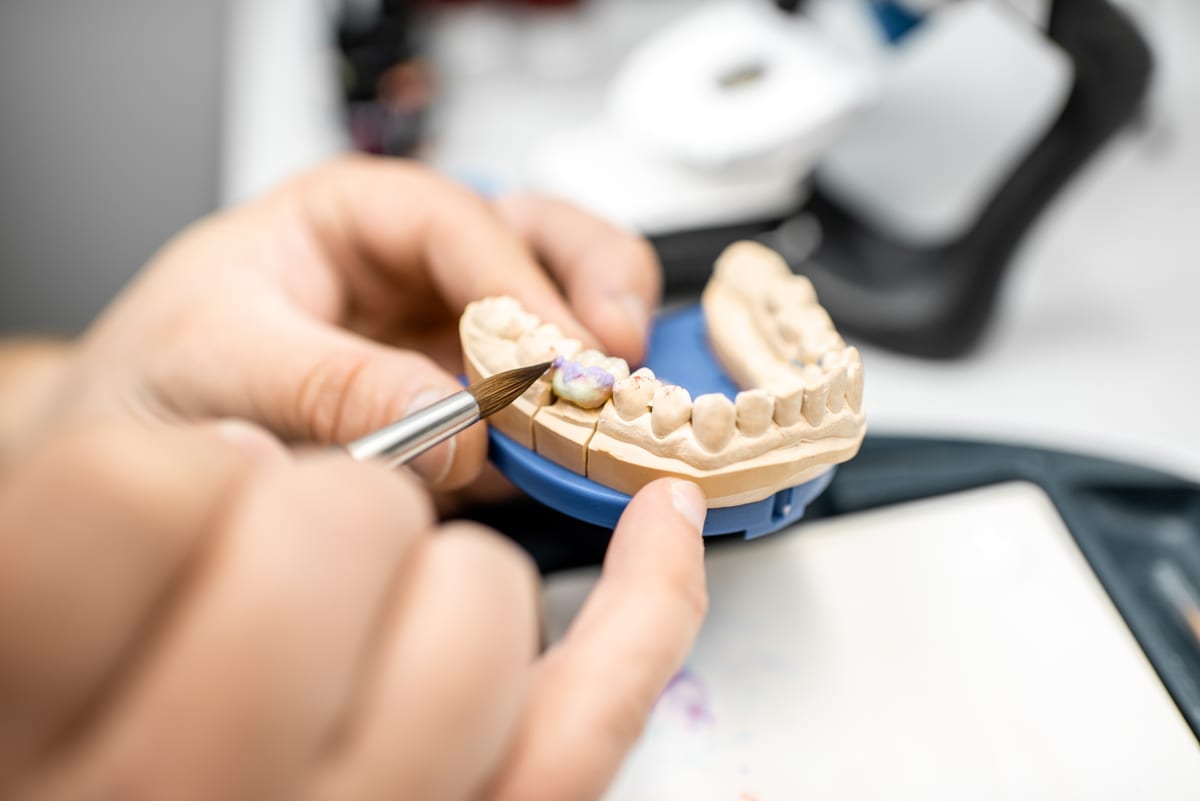 Dental Crowns in Taylors